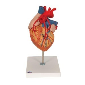 [3B] 4파트 2배관상동맥 우회술 심장모형 G06(32x18x18cm/0.99kg) ▶ Heart with Bypass, 2 times life size, 4 part 인체모형 교육용모형