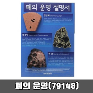 [SY] 79148 폐의운명 교육입체판넬 교육기자재