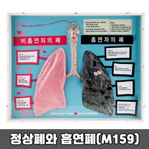 [SY] 정상폐와 흡연폐(폐비교모형) M159｜흡연교육 폐모형 교육용모형 보건교육 금연보건교육