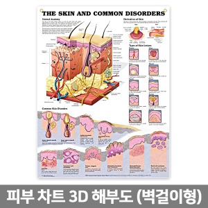 3D해부도(벽걸이)/ 9940B /피부차트 (THE SKIN AND COMMON DISORDERS )/ 54cm ⅹ 74cm