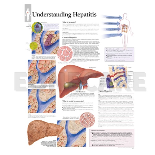 평면해부도(벽걸이)/ 1950 /간염의 이해/Understanding hepatitis