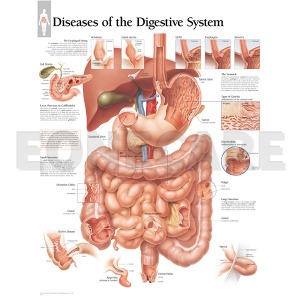 평면해부도(벽걸이) /소화기관의 질병/ 1552 Diseases of the Digestive System