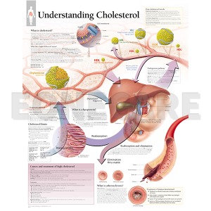 평면해부도(벽걸이)/ 콜레스테롤의 이해/1651 Understanding Cholesterol