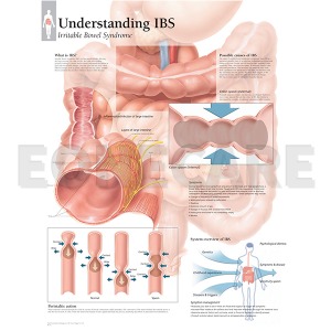 평면해부도(벽걸이)/ 1551 /과민성대장증후군/Understanding IBS