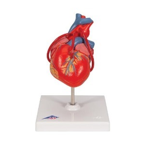 [3B] 2파트 관상동맥 우회술 심장모형 G05(19x12x12cm/0.31kg) ▶ Classic Heart with Bypass, 2 part 인체모형