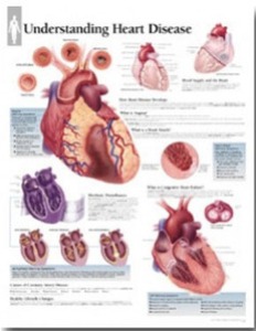 평면해부도(벽걸이)/1454/심장질환의 이해 Understanding Heart Disease