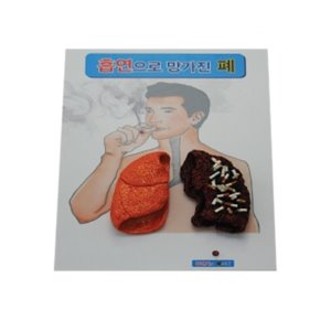 EBK3-440 흡연으로 망가진 폐 금연모형 /  폐질환모형 폐비교모형 폐모형 인체모형 입체모형 금연교육 금연교구 청소년금연교육 흡연예방