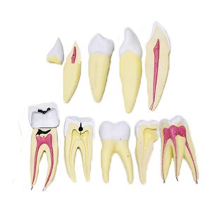 EBK3-317 치아 8배 확대모형 / 치아모형 인체모형 분해모형 치아구조설명 치아교육 교육모형 분리모형