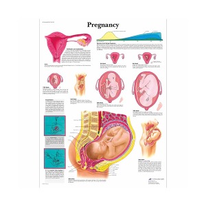 [독일3B] 임신차트 VR1554L(코팅) Pregnancy Chart