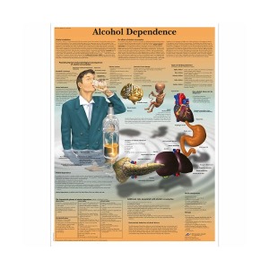 [독일3B] 알코올 중독차트 VR1792L(코팅) Drug Dependence Chart